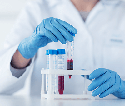 或≥500 μL血清(推薦)